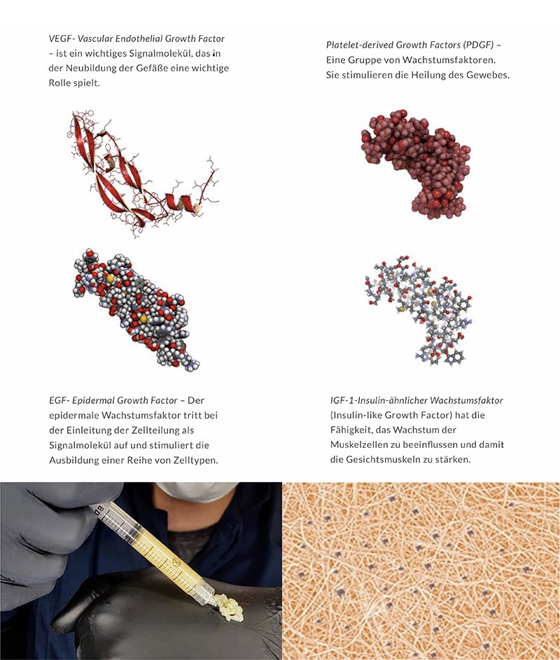 Plasma Bio Gel Filler นวัตกรรมใหม่ล่าสุด ฟิลเลอร์บริสุทธิ์ ที่สกัดจากเลือดของผู้เข้ารักษาเอง 100% Plasma Bio Gel Filler นวัตกรรมใหม่ล่าสุด ฟิลเลอร์บริสุทธิ์ ที่สกัดจากเลือดของผู้เข้ารักษาเอง 100%