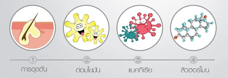 เป็นสิวจากการใส่หน้ากากอนามัยทำอย่างไรดี เป็นสิวจากการใส่หน้ากากอนามัยทำอย่างไรดี
