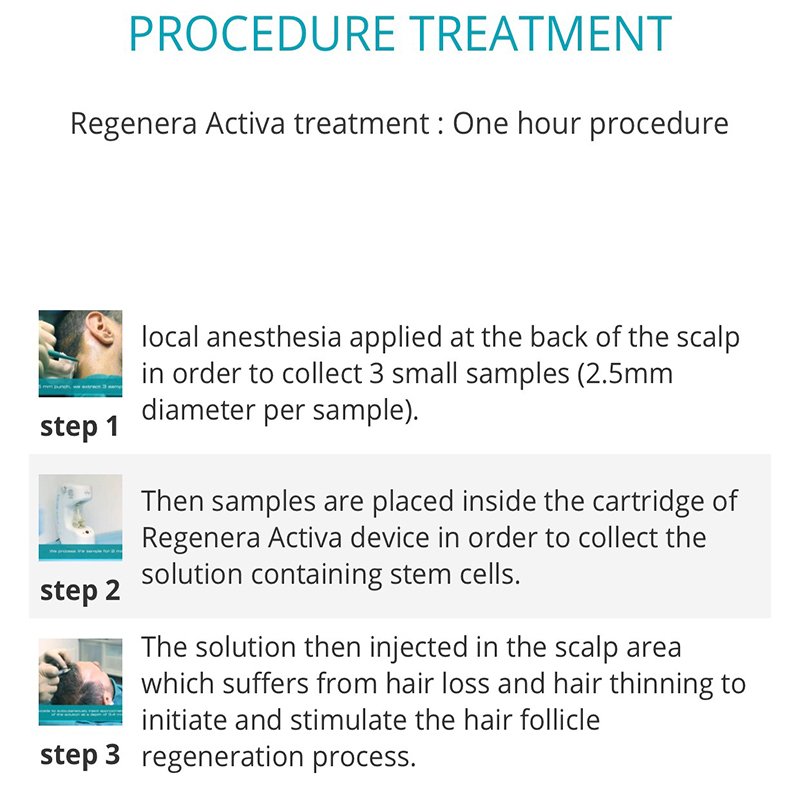ปลูกผมด้วยเทคนิคพิเศษล่าสุด Regenera Hair Stem MicroTransplantation Plus (HSMT+) ปลูกผมด้วยเทคนิคพิเศษล่าสุด Regenera Hair Stem MicroTransplantation Plus (HSMT+)