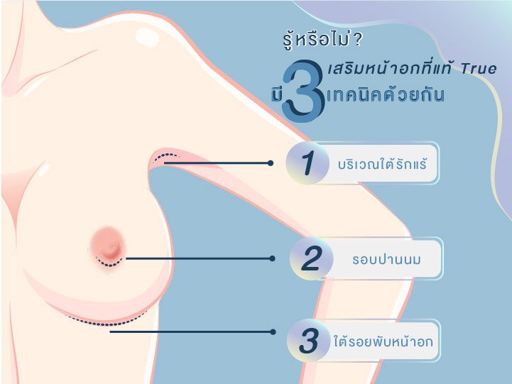 https://th.yanhee.net/%E0%B9%80%E0%B8%81%E0%B8%A3%E0%B9%87%E0%B8%94%E0%B8%84%E0%B8%A7%E0%B8%B2%E0%B8%A1%E0%B8%A3%E0%B8%B9%E0%B9%89/%E0%B8%A3%E0%B8%AD%E0%B8%A2%E0%B9%81%E0%B8%9C%E0%B8%A5%E0%B8%88%E0%B8%B2%E0%B8%81%E0%B8%81%E0%B8%B2%E0%B8%A3%E0%B9%80%E0%B8%AA%E0%B8%A3%E0%B8%B4%E0%B8%A1%E0%B8%AB%E0%B8%99%E0%B9%89%E0%B8%B2%E0%B8%AD%E0%B8%81%E0%B9%81%E0%B8%9A%E0%B8%9A%E0%B9%84%E0%B8%AB%E0%B8%99%E0%B9%83%E0%B8%8A%E0%B9%88%E0%B9%80%E0%B8%A5%E0%B8%A2/ https://th.yanhee.net/%E0%B9%80%E0%B8%81%E0%B8%A3%E0%B9%87%E0%B8%94%E0%B8%84%E0%B8%A7%E0%B8%B2%E0%B8%A1%E0%B8%A3%E0%B8%B9%E0%B9%89/%E0%B8%A3%E0%B8%AD%E0%B8%A2%E0%B9%81%E0%B8%9C%E0%B8%A5%E0%B8%88%E0%B8%B2%E0%B8%81%E0%B8%81%E0%B8%B2%E0%B8%A3%E0%B9%80%E0%B8%AA%E0%B8%A3%E0%B8%B4%E0%B8%A1%E0%B8%AB%E0%B8%99%E0%B9%89%E0%B8%B2%E0%B8%AD%E0%B8%81%E0%B9%81%E0%B8%9A%E0%B8%9A%E0%B9%84%E0%B8%AB%E0%B8%99%E0%B9%83%E0%B8%8A%E0%B9%88%E0%B9%80%E0%B8%A5%E0%B8%A2/https://th.yanhee.net/%E0%B9%80%E0%B8%81%E0%B8%A3%E0%B9%87%E0%B8%94%E0%B8%84%E0%B8%A7%E0%B8%B2%E0%B8%A1%E0%B8%A3%E0%B8%B9%E0%B9%89/%E0%B8%A3%E0%B8%AD%E0%B8%A2%E0%B9%81%E0%B8%9C%E0%B8%A5%E0%B8%88%E0%B8%B2%E0%B8%81%E0%B8%81%E0%B8%B2%E0%B8%A3%E0%B9%80%E0%B8%AA%E0%B8%A3%E0%B8%B4%E0%B8%A1%E0%B8%AB%E0%B8%99%E0%B9%89%E0%B8%B2%E0%B8%AD%E0%B8%81%E0%B9%81%E0%B8%9A%E0%B8%9A%E0%B9%84%E0%B8%AB%E0%B8%99%E0%B9%83%E0%B8%8A%E0%B9%88%E0%B9%80%E0%B8%A5%E0%B8%A2/