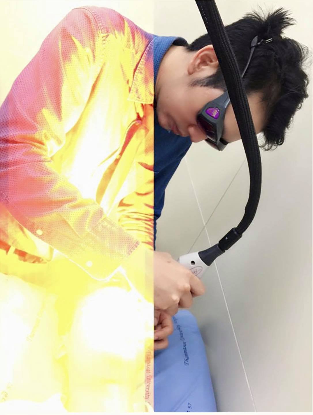 เป็นฝ้าแล้วต้องรีบเลเซอร์ไหม? เป็นฝ้าแล้วต้องรีบเลเซอร์ไหม?