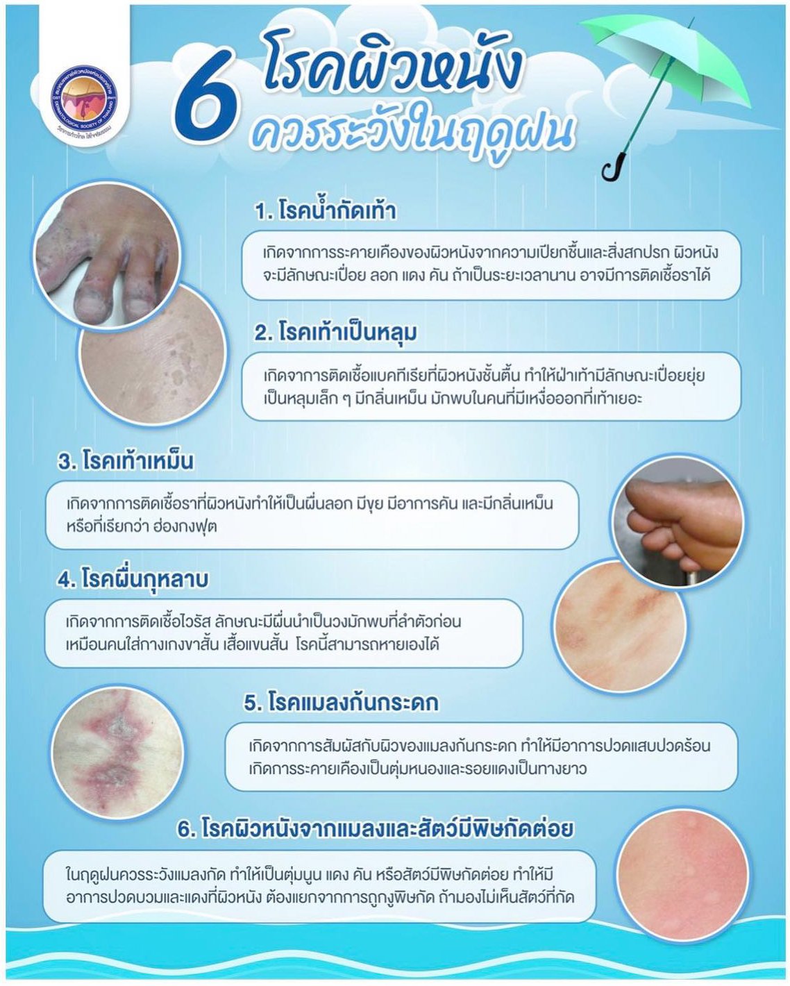 ระวังโรคผิวหนังที่มากับหน้าฝน!!!