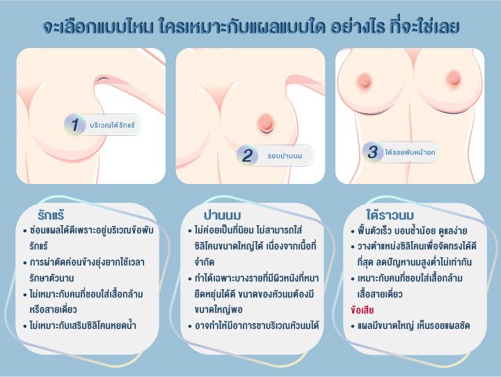 https://th.yanhee.net/%E0%B9%80%E0%B8%81%E0%B8%A3%E0%B9%87%E0%B8%94%E0%B8%84%E0%B8%A7%E0%B8%B2%E0%B8%A1%E0%B8%A3%E0%B8%B9%E0%B9%89/%E0%B8%A3%E0%B8%AD%E0%B8%A2%E0%B9%81%E0%B8%9C%E0%B8%A5%E0%B8%88%E0%B8%B2%E0%B8%81%E0%B8%81%E0%B8%B2%E0%B8%A3%E0%B9%80%E0%B8%AA%E0%B8%A3%E0%B8%B4%E0%B8%A1%E0%B8%AB%E0%B8%99%E0%B9%89%E0%B8%B2%E0%B8%AD%E0%B8%81%E0%B9%81%E0%B8%9A%E0%B8%9A%E0%B9%84%E0%B8%AB%E0%B8%99%E0%B9%83%E0%B8%8A%E0%B9%88%E0%B9%80%E0%B8%A5%E0%B8%A2/ https://th.yanhee.net/%E0%B9%80%E0%B8%81%E0%B8%A3%E0%B9%87%E0%B8%94%E0%B8%84%E0%B8%A7%E0%B8%B2%E0%B8%A1%E0%B8%A3%E0%B8%B9%E0%B9%89/%E0%B8%A3%E0%B8%AD%E0%B8%A2%E0%B9%81%E0%B8%9C%E0%B8%A5%E0%B8%88%E0%B8%B2%E0%B8%81%E0%B8%81%E0%B8%B2%E0%B8%A3%E0%B9%80%E0%B8%AA%E0%B8%A3%E0%B8%B4%E0%B8%A1%E0%B8%AB%E0%B8%99%E0%B9%89%E0%B8%B2%E0%B8%AD%E0%B8%81%E0%B9%81%E0%B8%9A%E0%B8%9A%E0%B9%84%E0%B8%AB%E0%B8%99%E0%B9%83%E0%B8%8A%E0%B9%88%E0%B9%80%E0%B8%A5%E0%B8%A2/