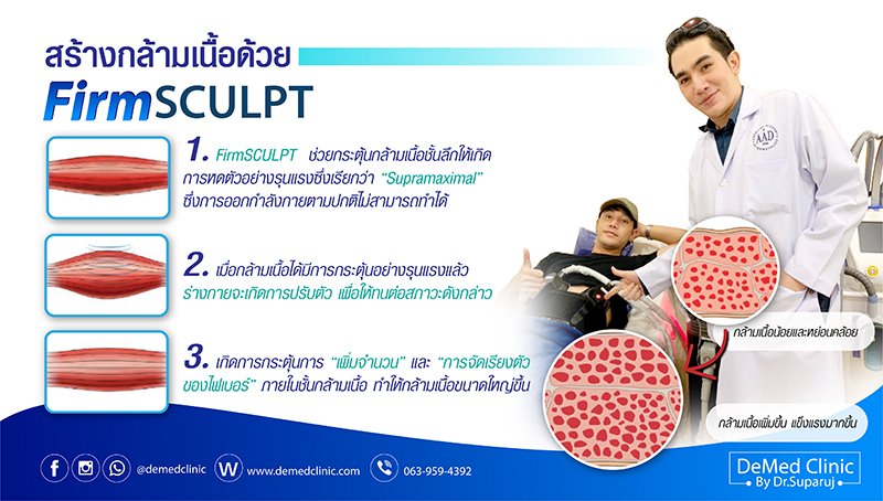 ขั้นตอนการทำ  รับการปรึกษาพร้อมประเมินสภาพ สรีระร่างกายโดย Specialist พร้อมรับหัตถการ เพียงนั่งหรือ นอนสบายๆในระหว่างการรับบริการ จำนวน 2 ครั้ง / สัปดาห์ เพียง 4 – 6 ครั้ง ก็จะเห็นลัพธ์ภายใน 2 – 4 สัปดาห์หลังรับหัตถการ