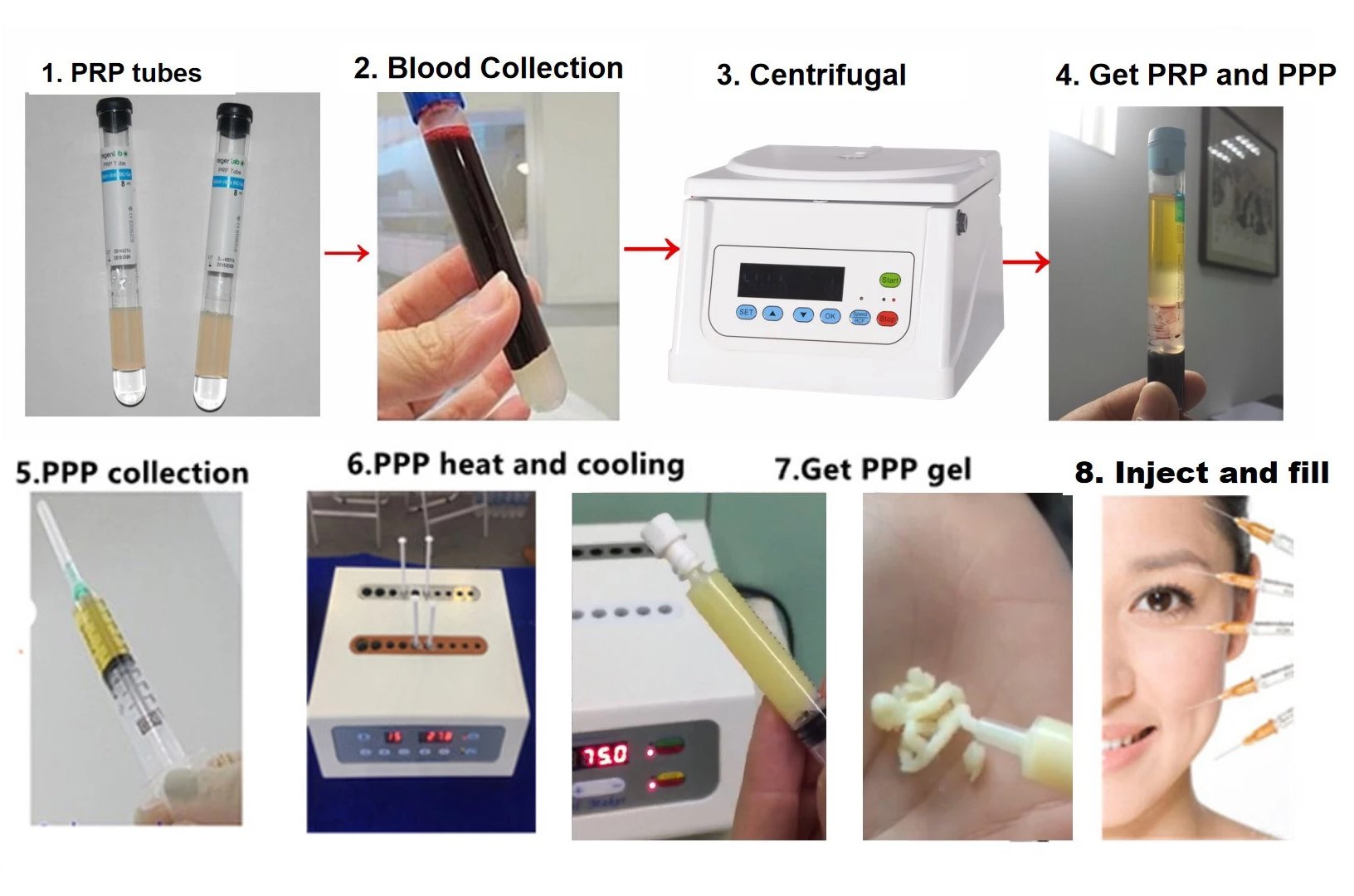 Plasma Bio Gel Filler นวัตกรรมใหม่ล่าสุด ฟิลเลอร์บริสุทธิ์ ที่สกัดจากเลือดของผู้เข้ารักษาเอง 100% Plasma Bio Gel Filler นวัตกรรมใหม่ล่าสุด ฟิลเลอร์บริสุทธิ์ ที่สกัดจากเลือดของผู้เข้ารักษาเอง 100%