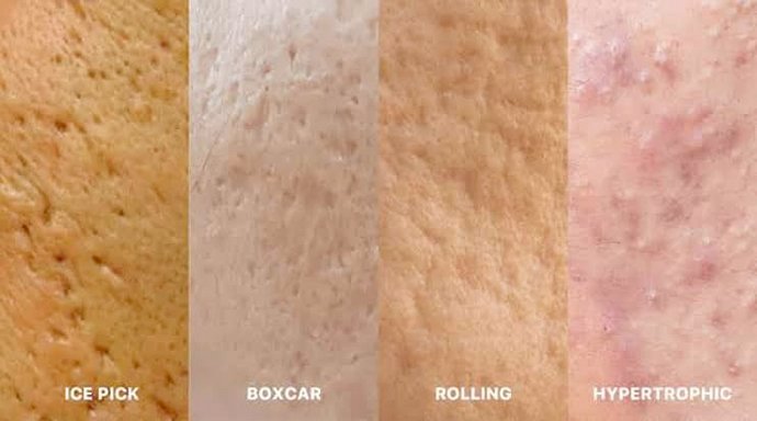 ผลลัพธ์อาจแตกต่างกันไป แล้วแต่บุคคล ผลลัพธ์อาจแตกต่างกันไป แล้วแต่บุคคล