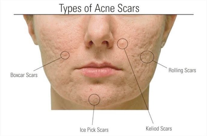 ผลลัพธ์อาจแตกต่างกันไป แล้วแต่บุคคล ผลลัพธ์อาจแตกต่างกันไป แล้วแต่บุคคล