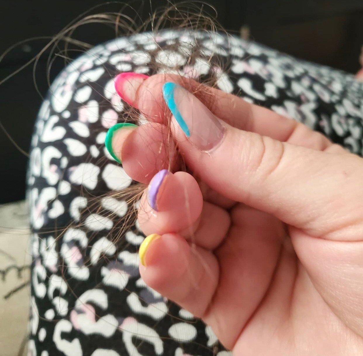 ผมร่วงทั่วศีรษะ (Telogen Effluvium) คืออะไร รักษาได้อย่างไร? ผมร่วงทั่วศีรษะ (Telogen Effluvium) คืออะไร รักษาได้อย่างไร?