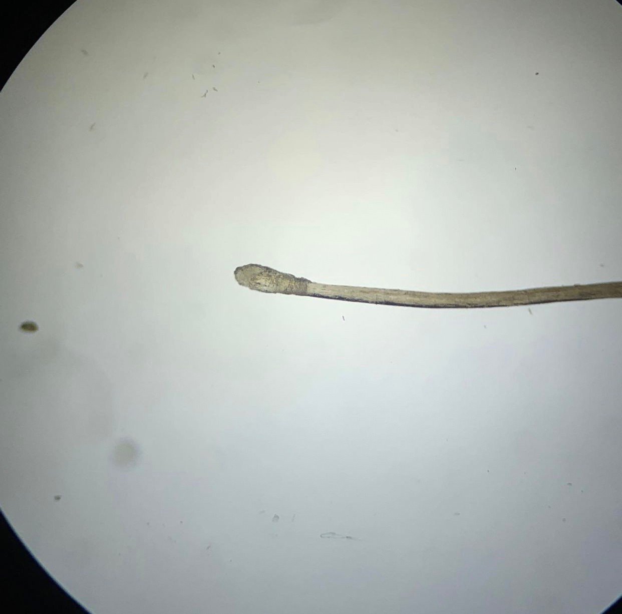 ผมร่วงทั่วศีรษะ (Telogen Effluvium) คืออะไร รักษาได้อย่างไร? ผมร่วงทั่วศีรษะ (Telogen Effluvium) คืออะไร รักษาได้อย่างไร?