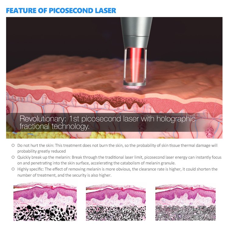 Combination treatment การใช้การรักษาหลายวิธีร่วมกันเช่นการใช้เลเซอร์สองถึงสามชนิด เช่น Pulsed dye laser PDL / IPL vascular cut off + Fractional CO 2 Laser / Fractional Picosecond Laser 