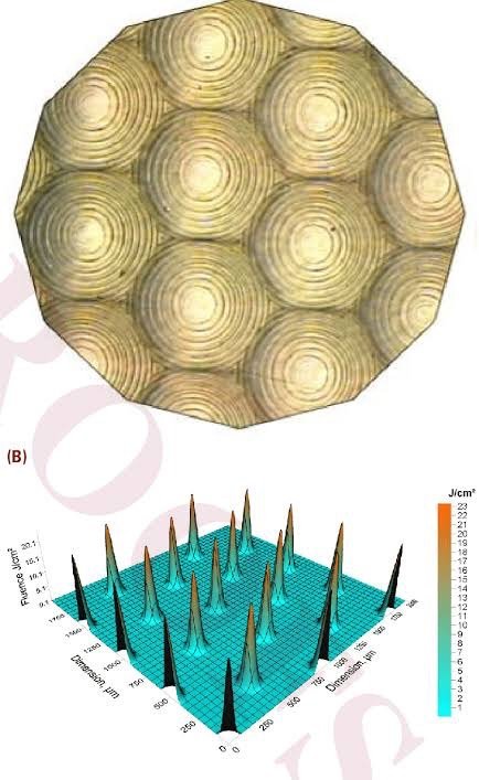 ดูแลหลุมสิว แผลเป็น รอยแตกลาย ด้วย Picosecond Laser เทคนิคเลนส์พิเศษ Micro Lens Array(MLA) ดูแลหลุมสิว แผลเป็น รอยแตกลาย ด้วย Picosecond Laser เทคนิคเลนส์พิเศษ Micro Lens Array(MLA)
