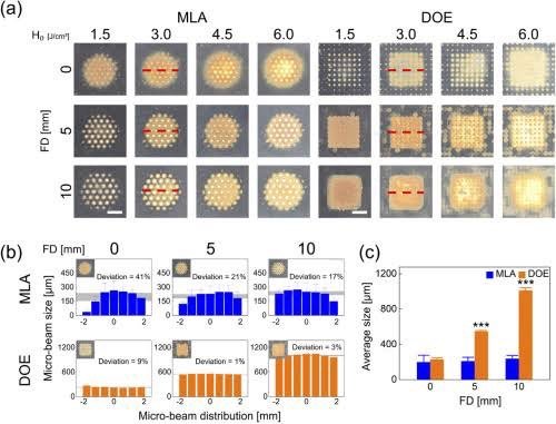 ดูแลหลุมสิว แผลเป็น รอยแตกลาย ด้วย Picosecond Laser เทคนิคเลนส์พิเศษ Micro Lens Array(MLA) ดูแลหลุมสิว แผลเป็น รอยแตกลาย ด้วย Picosecond Laser เทคนิคเลนส์พิเศษ Micro Lens Array(MLA)