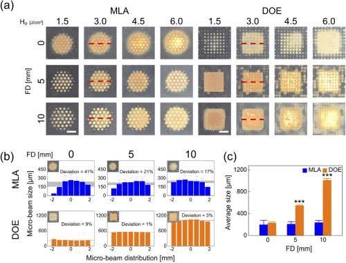 ดูแลหลุมสิว แผลเป็น รอยแตกลาย ด้วย Picosecond Laser เทคนิคเลนส์พิเศษ Micro Lens Array(MLA)