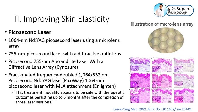 รูขุมขนกว้าง Enlarged Facial Pore ดูแลได้อย่างไร Part II? รูขุมขนกว้าง Enlarged Facial Pore ดูแลได้อย่างไร Part II?