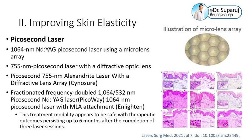 รูขุมขนกว้าง Enlarged Facial Pore เกิดจากอะไรและดูแลได้อย่างไร Part 3/3