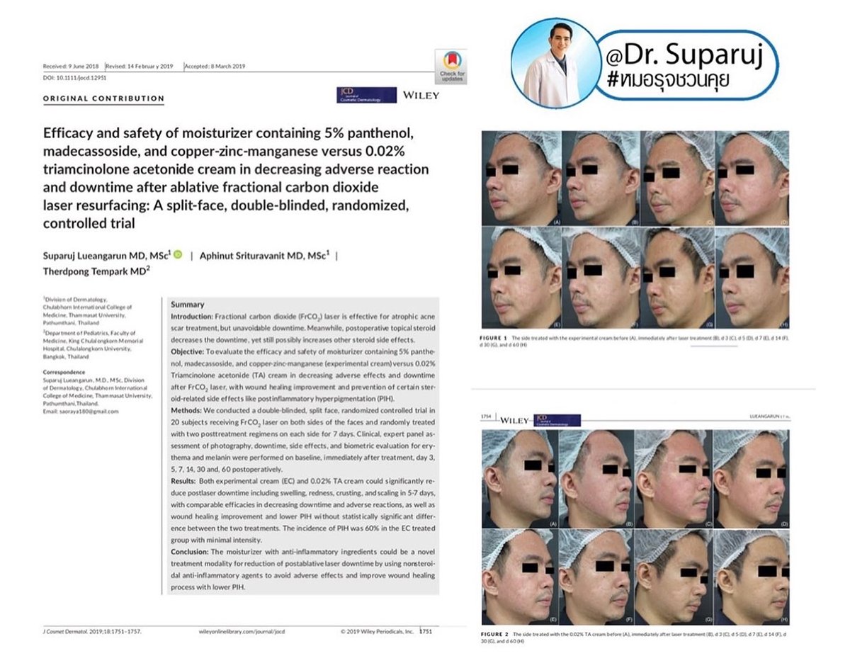 ฝ้าเลือด Telangiectatic Melasma ดูแลได้อย่างไร? ฝ้าเลือด Telangiectatic Melasma ดูแลได้อย่างไร?