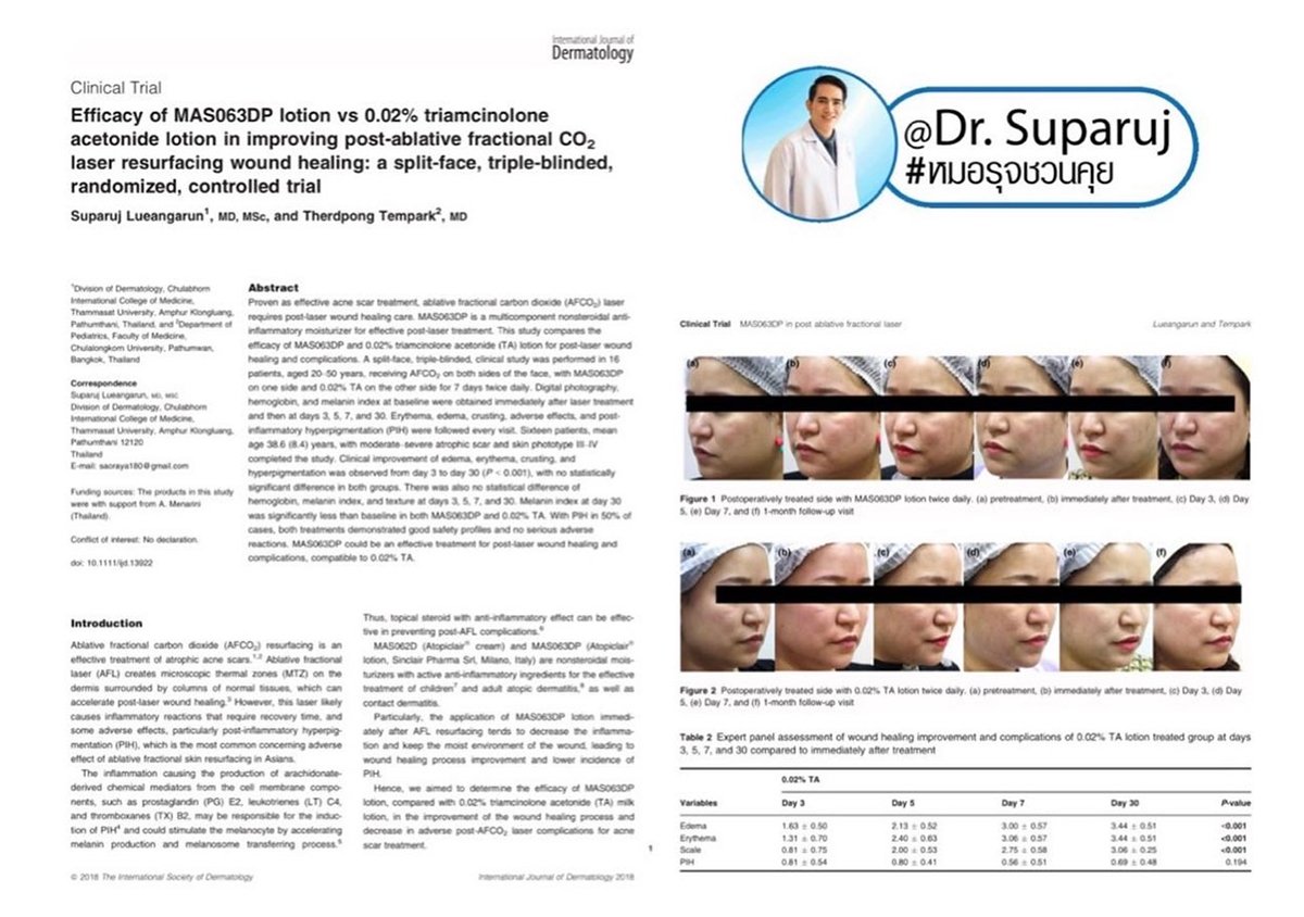 ฝ้าเลือด Telangiectatic Melasma ดูแลได้อย่างไร? ฝ้าเลือด Telangiectatic Melasma ดูแลได้อย่างไร?