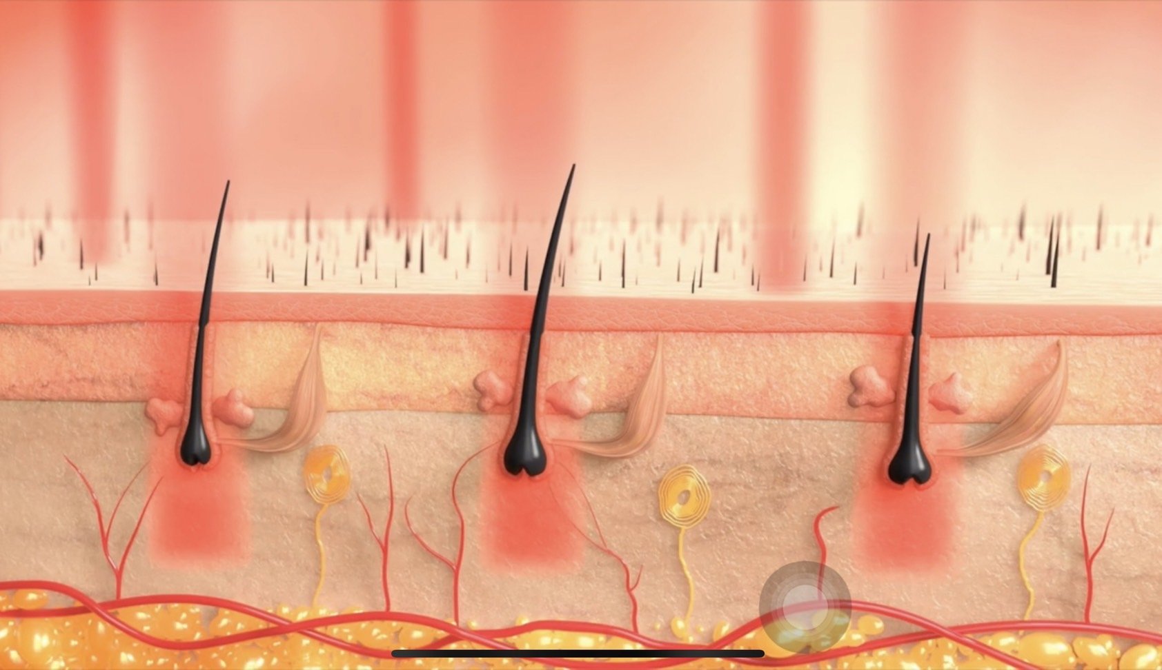 Hair Fraxel Regrow: เลเซอร์กระตุ้นรากผม ดูแลผมร่วงผมบาง Hair Fraxel Regrow: เลเซอร์กระตุ้นรากผม ดูแลผมร่วงผมบาง