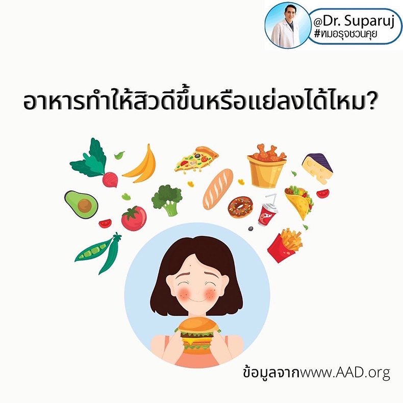 อาหารทำให้สิวดีขึ้นหรือแย่ลงได้ไหม? อาหารทำให้สิวดีขึ้นหรือแย่ลงได้ไหม?