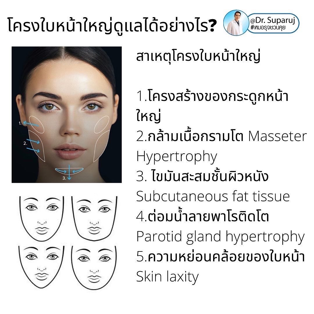 ทำไมไปฉีดโบทูลินั่มท็อกซินลดกราม แล้วหน้าไม่เรียวดั่งใจ เกิดจากอะไรได้บ้าง ? ทำไมไปฉีดโบทูลินั่มท็อกซินลดกราม แล้วหน้าไม่เรียวดั่งใจ เกิดจากอะไรได้บ้าง ?