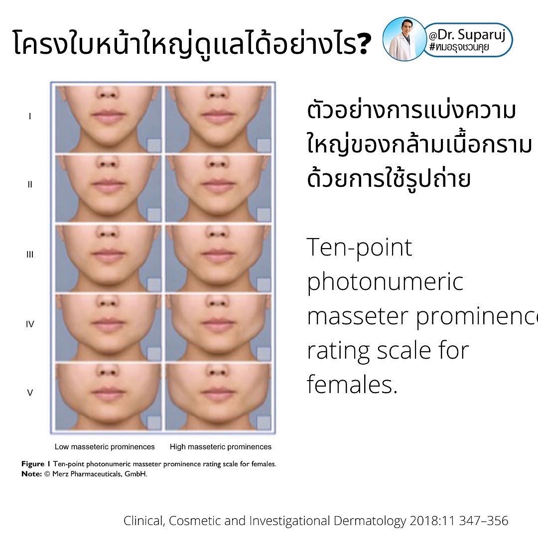 ทำไมไปฉีดโบทูลินั่มท็อกซินลดกราม แล้วหน้าไม่เรียวดั่งใจ เกิดจากอะไรได้บ้าง ? ทำไมไปฉีดโบทูลินั่มท็อกซินลดกราม แล้วหน้าไม่เรียวดั่งใจ เกิดจากอะไรได้บ้าง ?