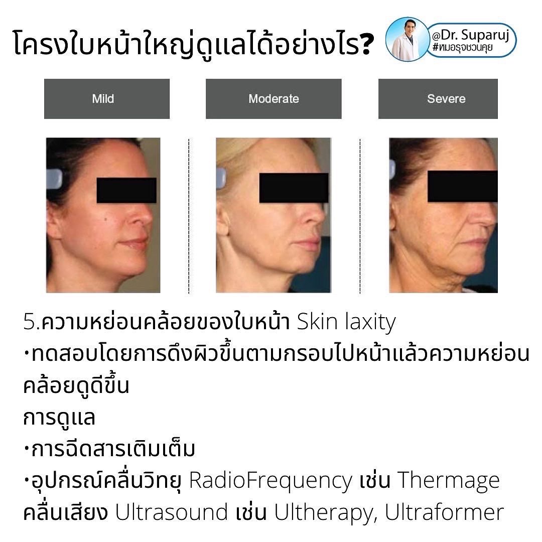 ทำไมไปฉีดโบทูลินั่มท็อกซินลดกราม แล้วหน้าไม่เรียวดั่งใจ เกิดจากอะไรได้บ้าง ? ทำไมไปฉีดโบทูลินั่มท็อกซินลดกราม แล้วหน้าไม่เรียวดั่งใจ เกิดจากอะไรได้บ้าง ?