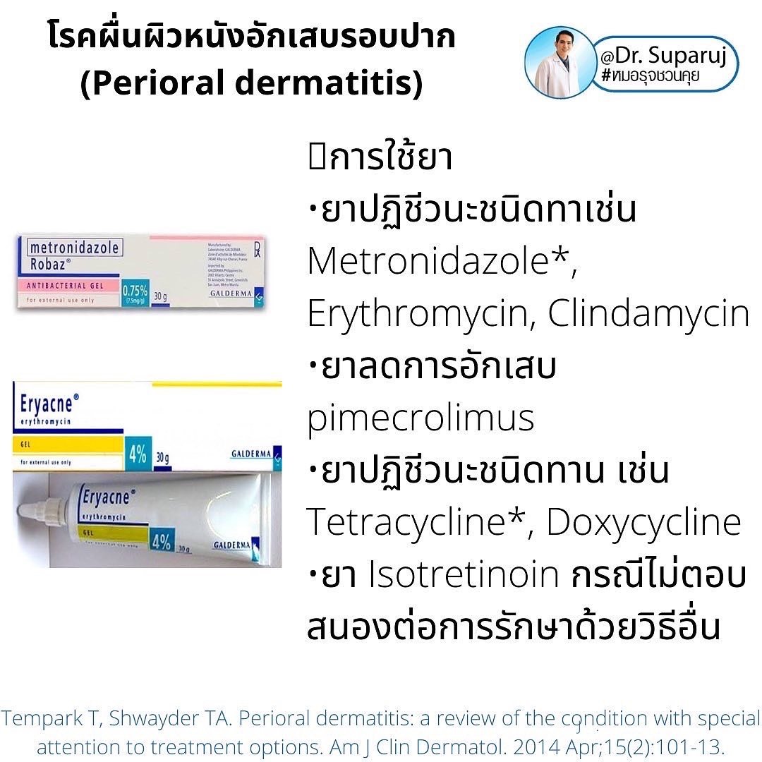 คล้ายสิว…แต่ไม่ใช่สิว… …ผื่นผิวหนังอักเสบรอบปาก (Perioral dermatitis, POD)