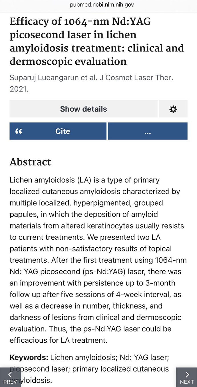 ผื่น lichen amyloidosus (หรือ amyloidosis) มีลักษณะอย่างไร ดูแลได้อย่างไร ผื่น lichen amyloidosus (หรือ amyloidosis) มีลักษณะอย่างไร ดูแลได้อย่างไร
