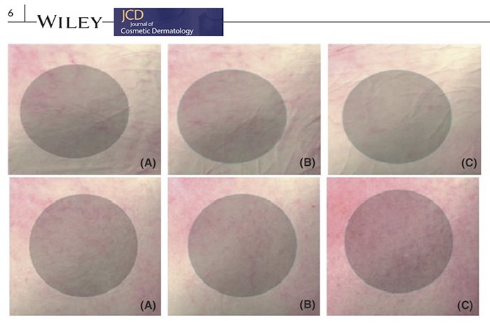 เทคนิคนิคการเลือก Moisturizer ครีมให้ความชุ่มชื้นผิว เทคนิคนิคการเลือก Moisturizer ครีมให้ความชุ่มชื้นผิว