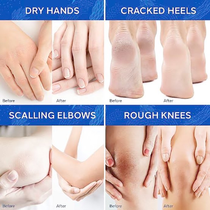 เทคนิคนิคการเลือก Moisturizer ครีมให้ความชุ่มชื้นผิว เทคนิคนิคการเลือก Moisturizer ครีมให้ความชุ่มชื้นผิว