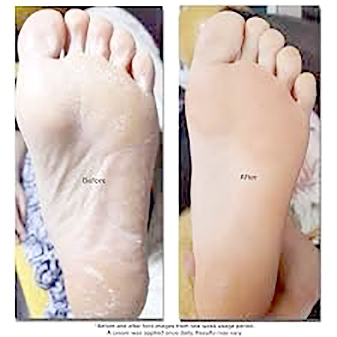 เทคนิคนิคการเลือก Moisturizer ครีมให้ความชุ่มชื้นผิว เทคนิคนิคการเลือก Moisturizer ครีมให้ความชุ่มชื้นผิว