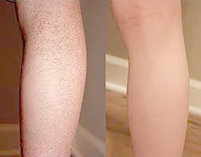 เทคนิคนิคการเลือก Moisturizer ครีมให้ความชุ่มชื้นผิว เทคนิคนิคการเลือก Moisturizer ครีมให้ความชุ่มชื้นผิว