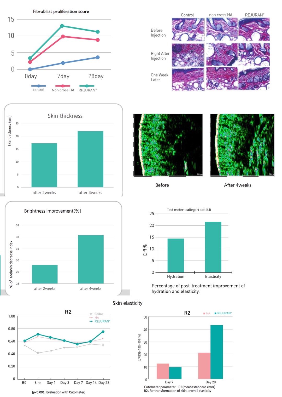 REJURAN HEALER เทคโนโลยี PN Polynucleotide ดูแลปัญหาหลุมสิว REJURAN HEALER เทคโนโลยี PN Polynucleotide ดูแลปัญหาหลุมสิว