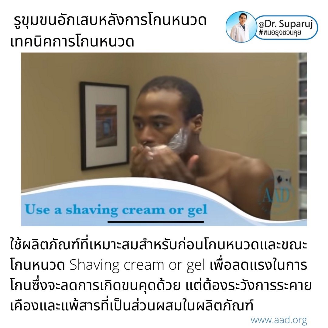 คล้ายสิว…แต่ไม่ใช่สิว: รูขุมขนอักเสบหลังการโกนหนวด Pseudofolliculitis barbae, Razor bump +เทคนิคการโกนหนวดเพื่อลดการเกิดรูขุมขนอักเสบครับ คล้ายสิว…แต่ไม่ใช่สิว: รูขุมขนอักเสบหลังการโกนหนวด Pseudofolliculitis barbae, Razor bump +เทคนิคการโกนหนวดเพื่อลดการเกิดรูขุมขนอักเสบครับ