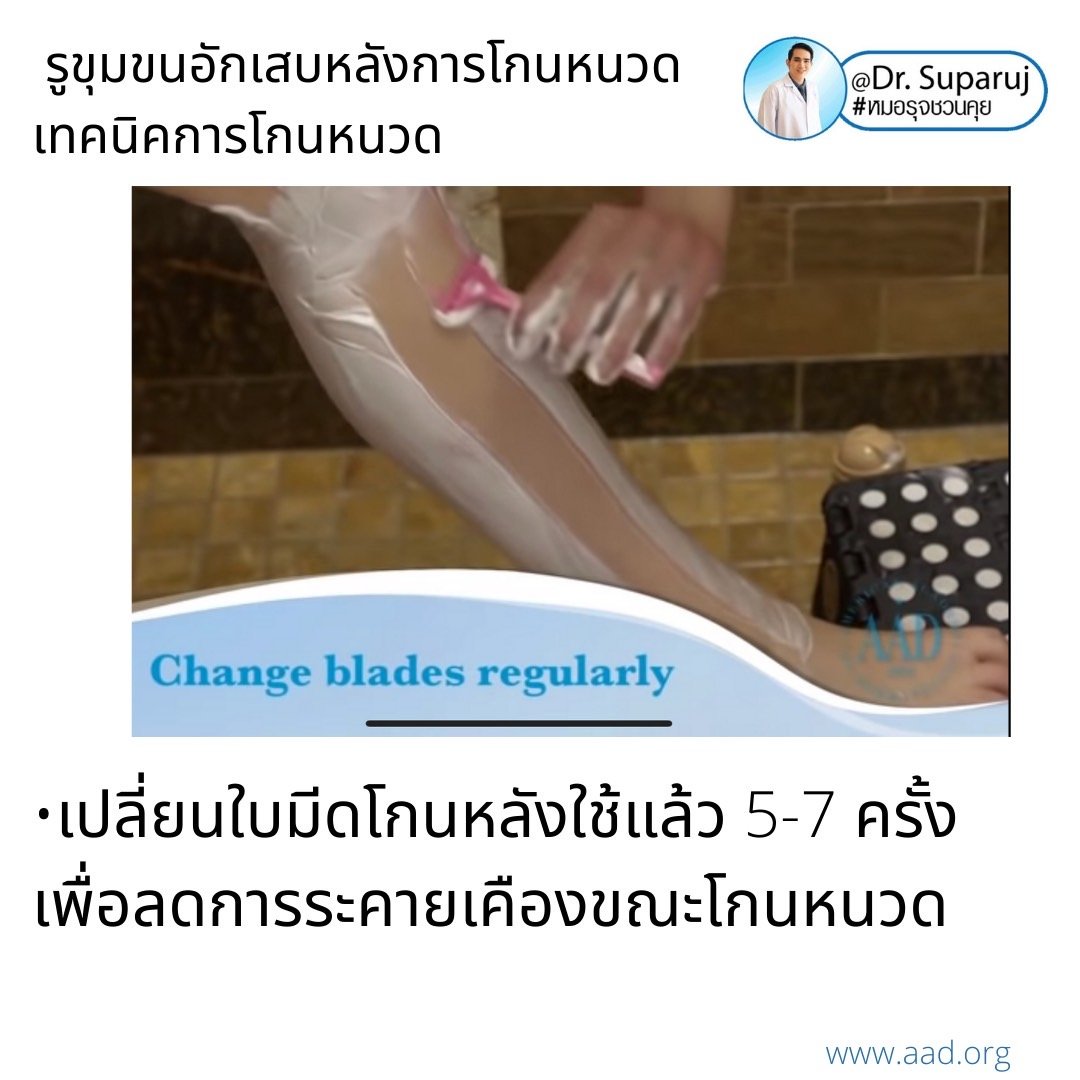 คล้ายสิว…แต่ไม่ใช่สิว: รูขุมขนอักเสบหลังการโกนหนวด Pseudofolliculitis barbae, Razor bump +เทคนิคการโกนหนวดเพื่อลดการเกิดรูขุมขนอักเสบครับ