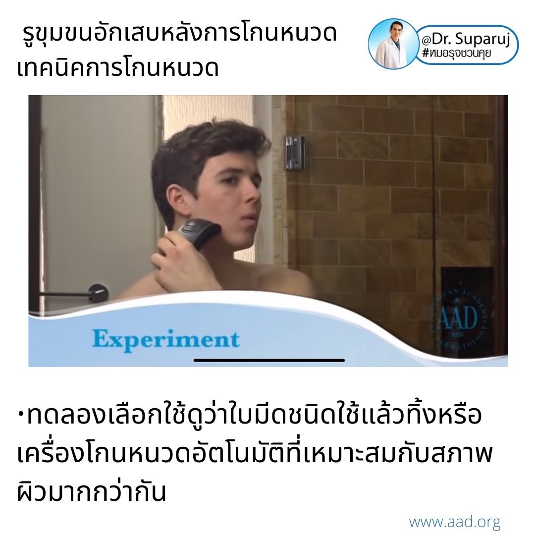 คล้ายสิว…แต่ไม่ใช่สิว: รูขุมขนอักเสบหลังการโกนหนวด Pseudofolliculitis barbae, Razor bump +เทคนิคการโกนหนวดเพื่อลดการเกิดรูขุมขนอักเสบครับ คล้ายสิว…แต่ไม่ใช่สิว: รูขุมขนอักเสบหลังการโกนหนวด Pseudofolliculitis barbae, Razor bump +เทคนิคการโกนหนวดเพื่อลดการเกิดรูขุมขนอักเสบครับ