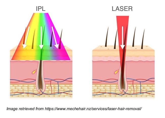 A-TONE Premium IPL & PIP Toning เทคนิคแสงความเข้มข้นสูง ดูแลปัญหาผิวหนัง สิว รอยดำ รอยแดง IPL คืออะไร ช่วยดูแลปัญหาผิวหนังอะไรได้บ้าง? A-TONE Premium IPL & PIP Toning เทคนิคแสงความเข้มข้นสูง ดูแลปัญหาผิวหนัง สิว รอยดำ รอยแดง IPL คืออะไร ช่วยดูแลปัญหาผิวหนังอะไรได้บ้าง?
