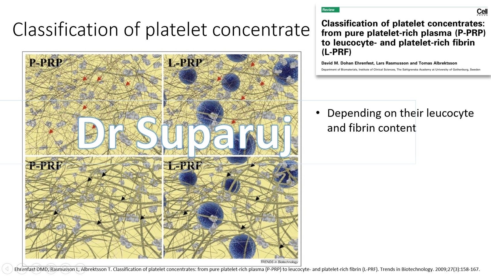 แนะนำเทคนิคดูแลหลุมสิว ep. 12 เกล็ดเลือดเข้มข้น Platelet-rich plasma (PRP)ในการดูแลรักษาหลุมสิว PRP in Acne Scar Treatment (อย่างละเอียดครับ)