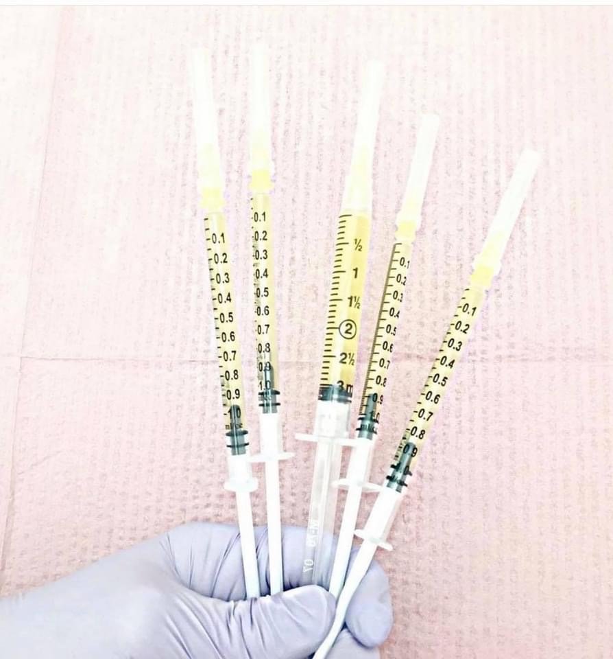 แนะนำเทคนิคดูแลหลุมสิว ep. 12 เกล็ดเลือดเข้มข้น Platelet-rich plasma (PRP)ในการดูแลรักษาหลุมสิว PRP in Acne Scar Treatment (อย่างละเอียดครับ) แนะนำเทคนิคดูแลหลุมสิว ep. 12 เกล็ดเลือดเข้มข้น Platelet-rich plasma (PRP)ในการดูแลรักษาหลุมสิว PRP in Acne Scar Treatment (อย่างละเอียดครับ)