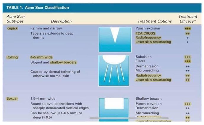 แนะนำเทคนิคดูแลหลุมสิว Ep. 19: วิเคราะห์ชนิดหลุมสิวเพื่อวางแผนการรักษา Acne Scar Analysis แนะนำเทคนิคดูแลหลุมสิว Ep. 19: วิเคราะห์ชนิดหลุมสิวเพื่อวางแผนการรักษา Acne Scar Analysis