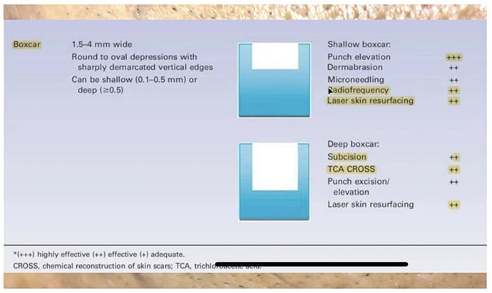 แนะนำเทคนิคดูแลหลุมสิว Ep. 19: วิเคราะห์ชนิดหลุมสิวเพื่อวางแผนการรักษา Acne Scar Analysis