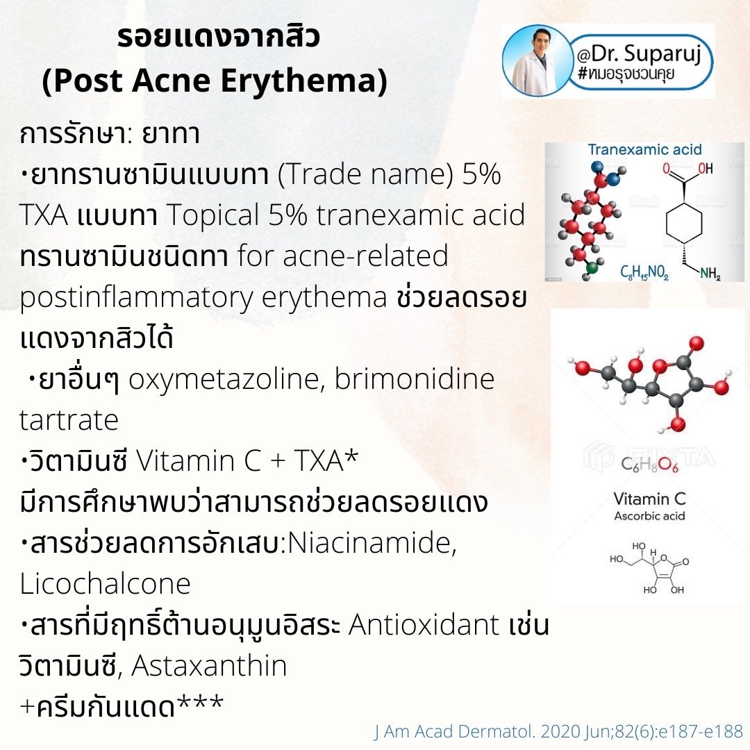 รอยแดงจากสิว (Post Acne Erythema) และ แผลเป็นหลุมสิวรอยแดงระยะแรก (Macular Acne Scar) เกิดจากอะไรและดูแลได้อย่างไร? (Update 2022)