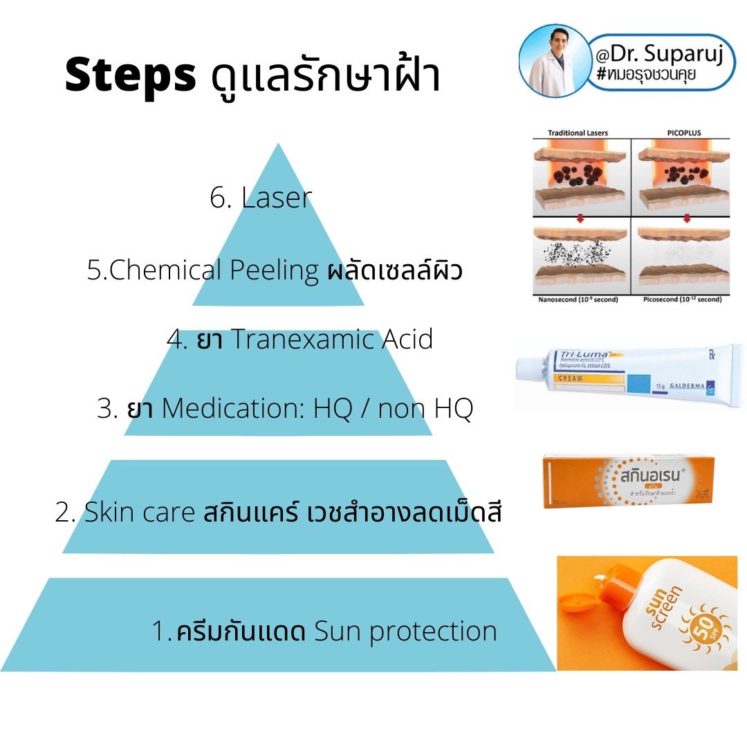 Update เทคนิครักษาฝ้า Melasma Treatment