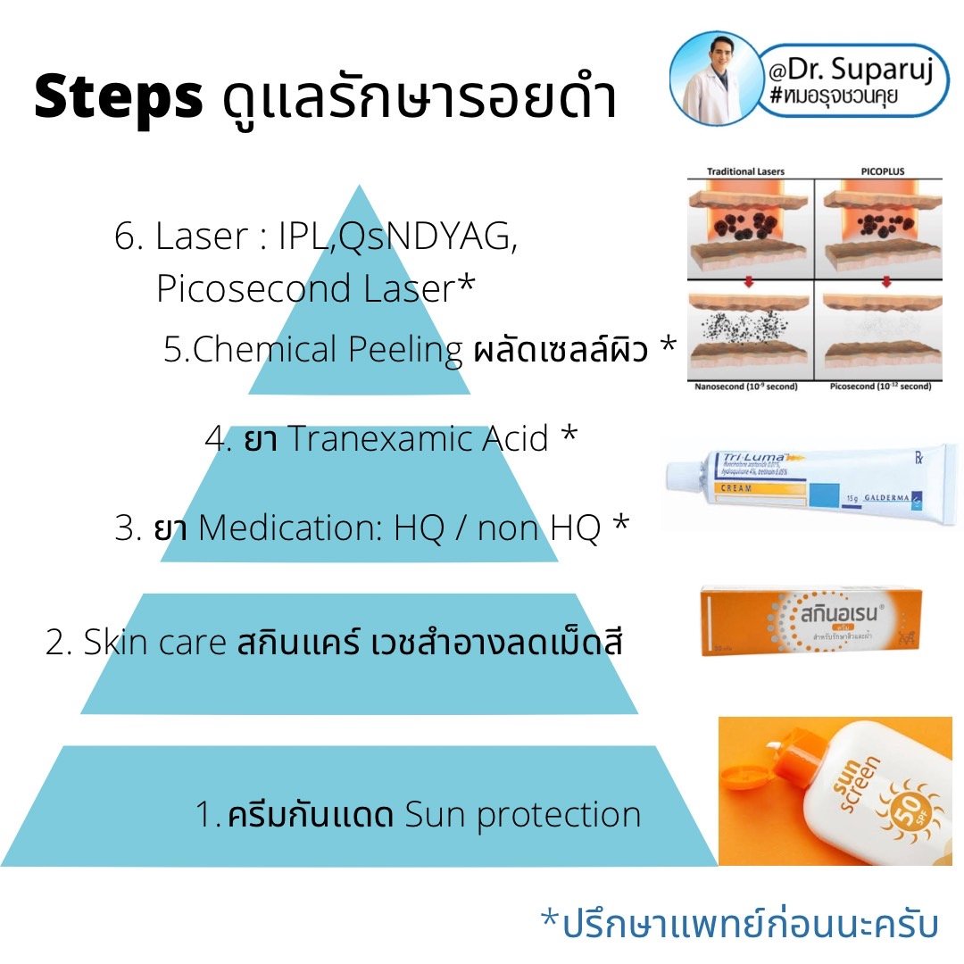 กระตื้น Freckle มีลักษณะอย่างไรดูแลได้อย่างไรบ้าง?