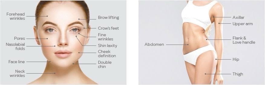 Ultraformer III Body นวัตกรรมสลายไขมันด้วย MMFU กระชับสัดส่วน โดยไม่ต้องผ่าตัด ไม่ต้องพักฟื้น Ultraformer III Body นวัตกรรมสลายไขมันด้วย MMFU กระชับสัดส่วน โดยไม่ต้องผ่าตัด ไม่ต้องพักฟื้น