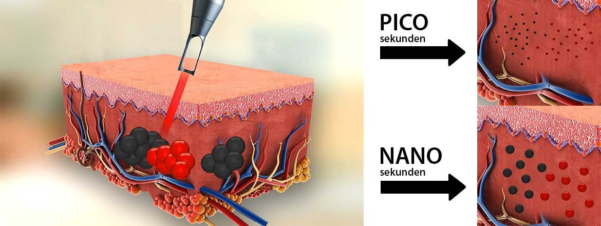 PicoLaser Melasma Treatment Program โปรแกรมดูแลฝ้าครบวงจร  PicoLaser Melasma Treatment Program โปรแกรมดูแลฝ้าครบวงจร