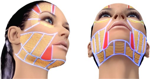 Ultra HIFU 3D Program ยกกระชับ ปรับรูปหน้า กระตุ้นคอลลาเจน Ultra HIFU 3D Program ยกกระชับ ปรับรูปหน้า กระตุ้นคอลลาเจน