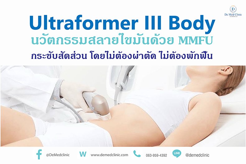 Ultraformer III Body นวัตกรรมสลายไขมันด้วย MMFU กระชับสัดส่วน โดยไม่ต้องผ่าตัด ไม่ต้องพักฟื้น