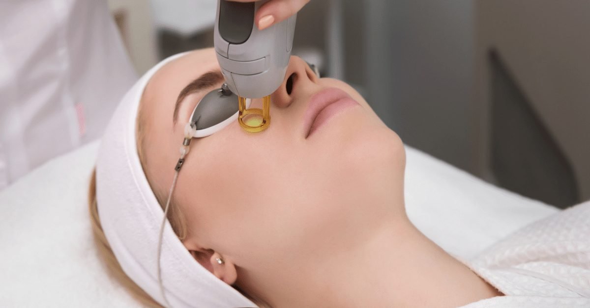 เทคนิคดูแลสิวด้วย Acne PDT Picosecond Laser Plus+ เทคนิคดูแลสิวด้วย Acne PDT Picosecond Laser Plus+