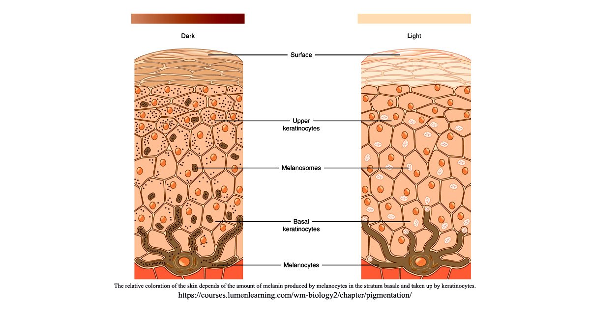 ฝ้ามีกี่ชนิด Melasma Type? ฝ้ามีกี่ชนิด Melasma Type?